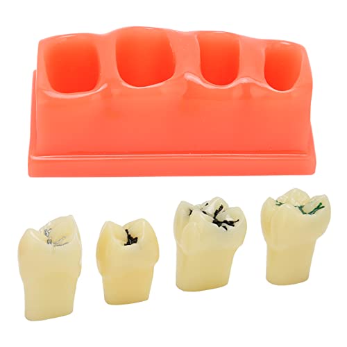 מודל שיניים של Natudeco דגם שיניים דגם שיניים דגם תצוגה מודל תצוגה גמישות מבנה ברור, כלי אימון נוח חזק ועמיד